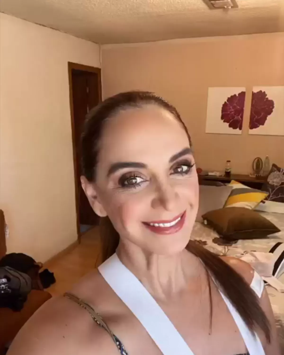 Lupita Jones impacta con operación en el hombro fotos