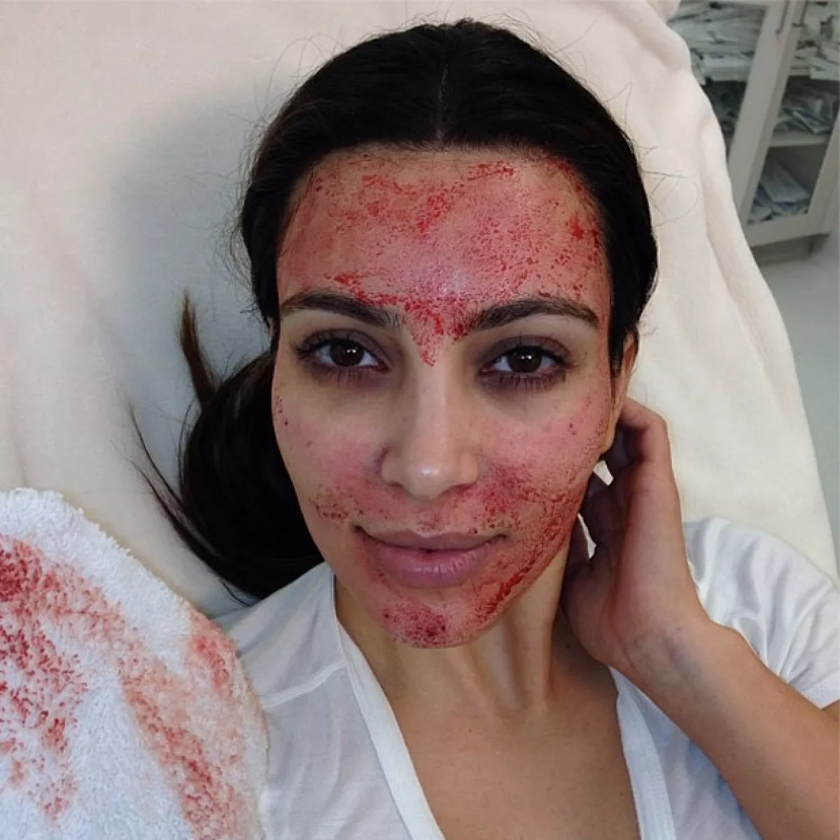Kim con el rostro lleno de sangre.