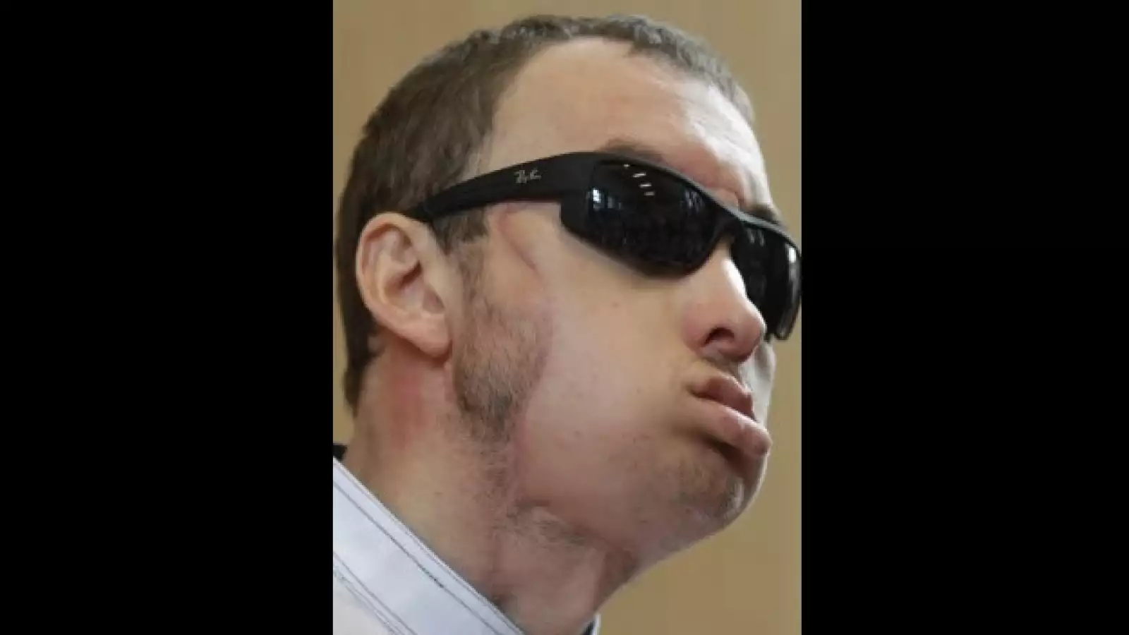 Grzegorz transplante 2013