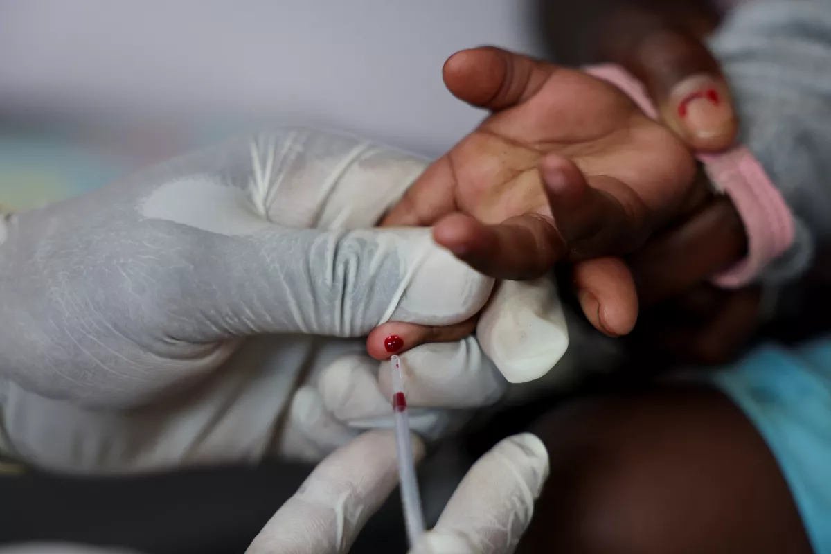 Una enfermera toma una muestra de sangre de un niño para una prueba de VIH en una clínica en Diepsloot, al norte de Johannesburgo, Sudáfrica, 12 de marzo de 2025. (Imagen principal del artículo web "Recortes de ayuda de EU agravan crisis del VIH en Sudáfrica: caen pruebas y seguimiento médico"). 