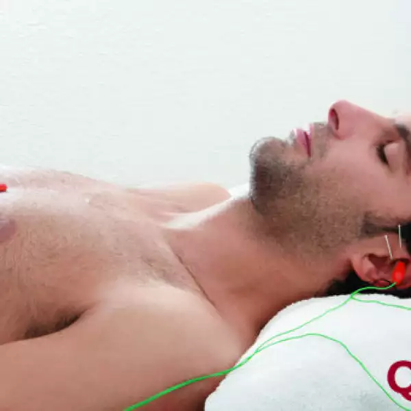 Electroacupuntura Ap