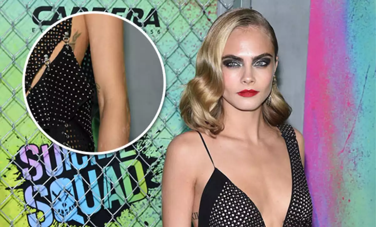 El estrés está acabando con la modelo y actriz, pues durante la premiere de Suicide Squad, su piel se vio muy afectada por psoriasis.