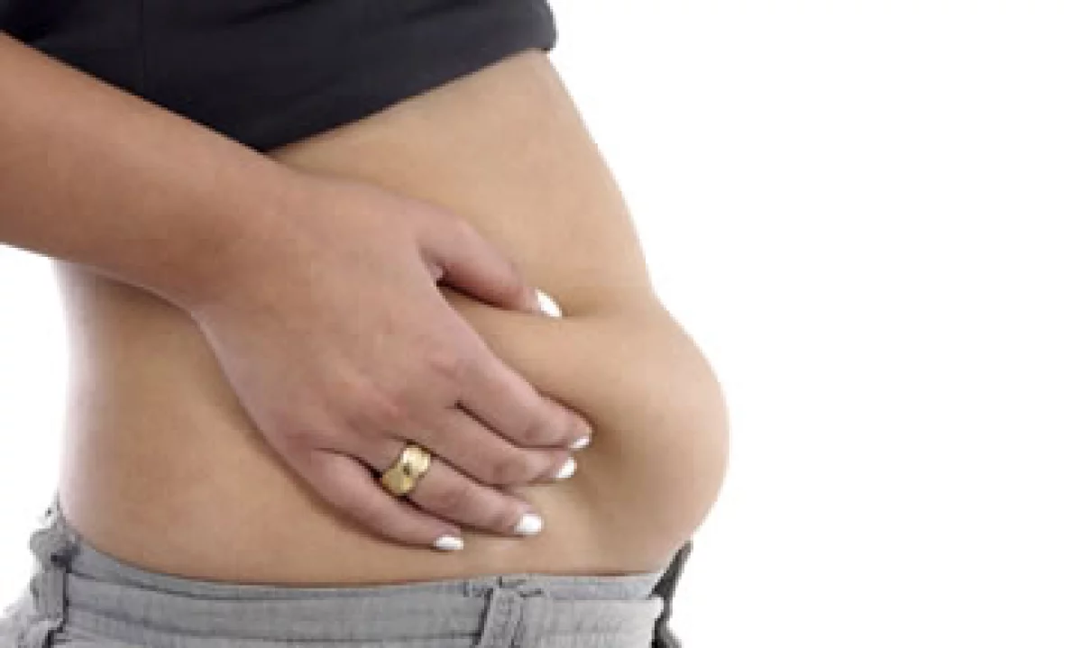 La industria en México ha emprendido acciones como la reformulación de productos para combatir la obesidad. (Foto: Getty Images)