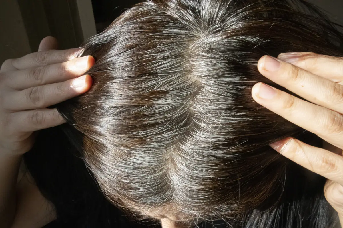 canas-en-ninos-es-normal
