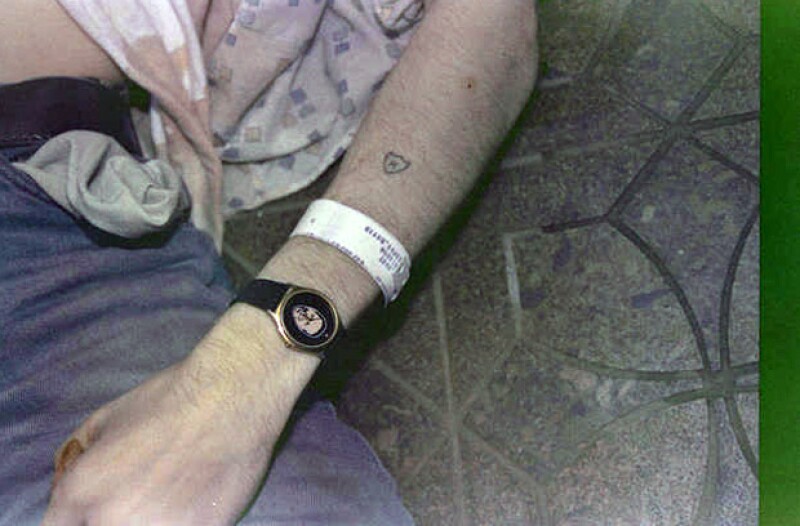 Una toma de su brazo en el que se alcanza a ver el brazalete de cuando estuvo en el centro de rehabilitación para dejar su adicción por la heroína.