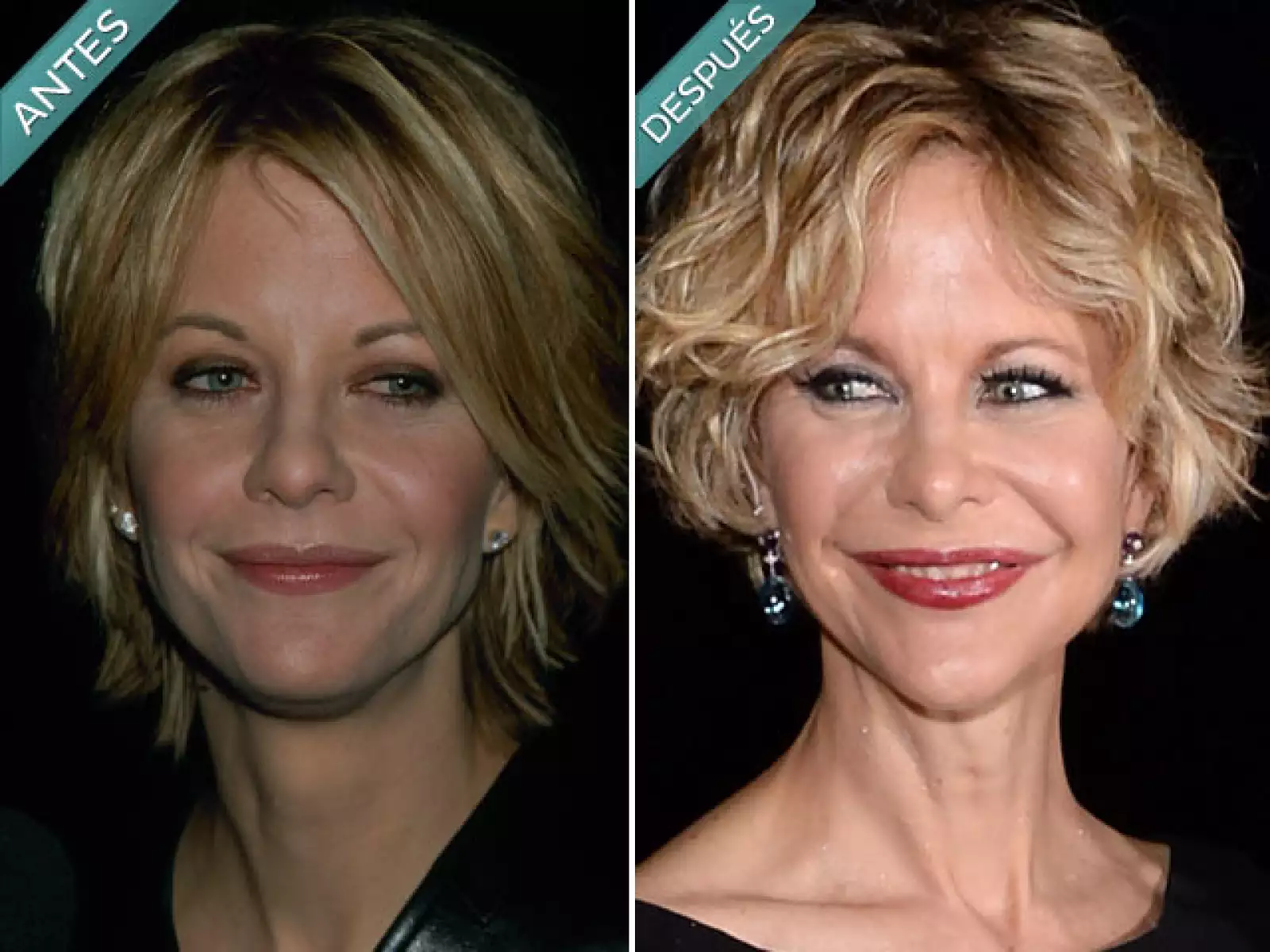 No pretendemos que Meg Ryan luzca como en los 90. A principios del 2000 lucía bien pero de pronto comenzó a abusar del colágeno, botox y una que otra restiradita.