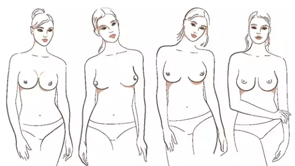 Tipos (en orden): Redondas, Este-Oeste, Separadas y Lágrima