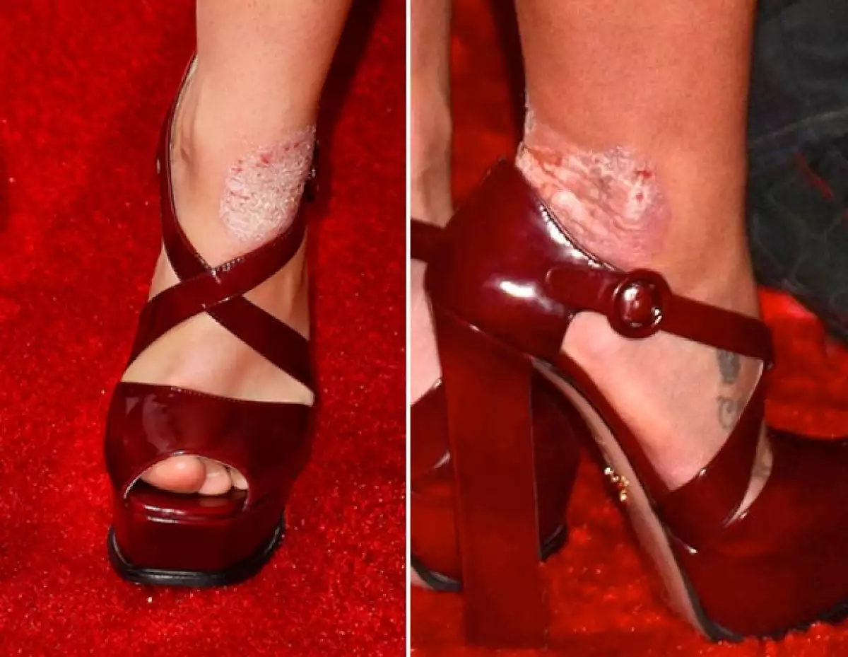 Así lucen sus tobillos y pies.