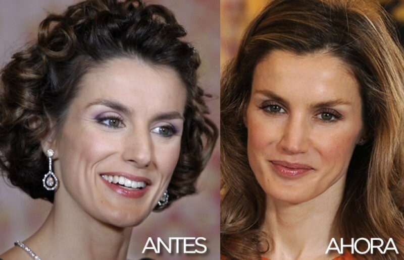 Aquí el antes y el después de su operación en la nariz.