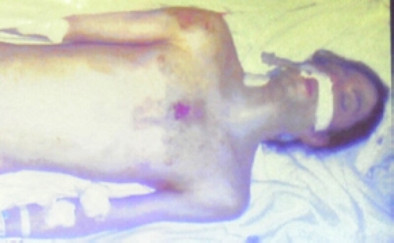 Así lucía el cuerpo de Michael Jackson horas después de morir.