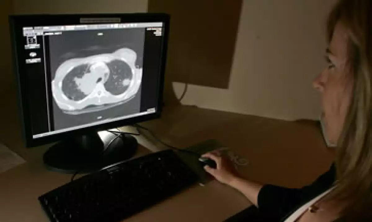 El Iridio-192 es utilizado para realizar radiografías industriales. (Foto: Getty Images)
