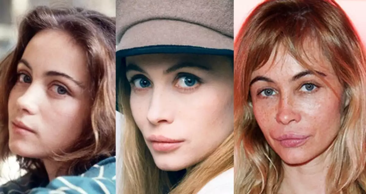 La actriz Emmanuelle Béart, de 48 años, busca crear consciencia entre las mujeres que buscan alterar su fisíco a través de procedimientos plásticos.