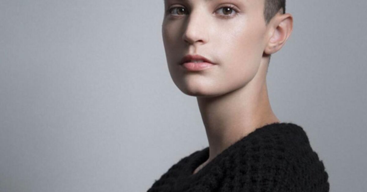 Ella es Dayna Christison, la joven con cáncer convertida en modelo(01)