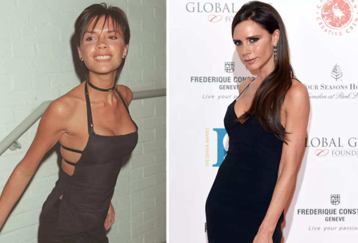 El antes y después de la piel de Victoria, ¿notas la diferencia?