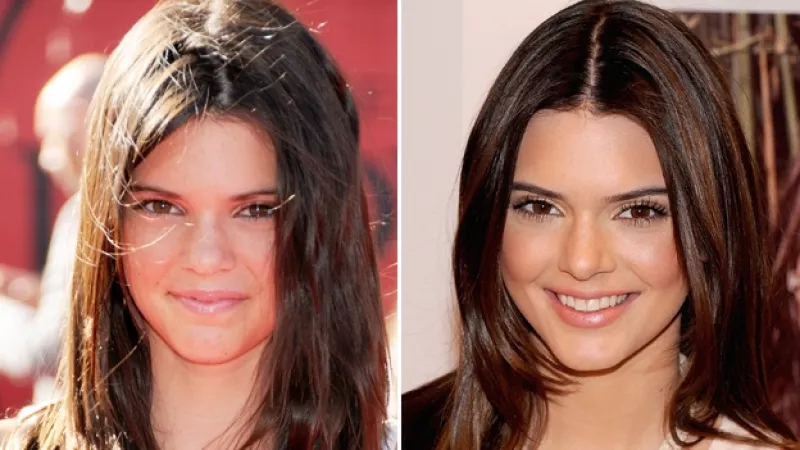 kendall