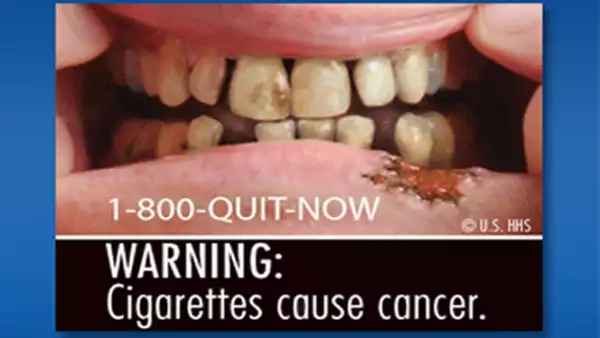 Entre las imágenes difundidas por la Administración de Alimentos y Medicinas de Estados Unidos (FDA, por sus siglas en inglés) hay dientes y encías putrefactas y un hombre con traqueotomía.