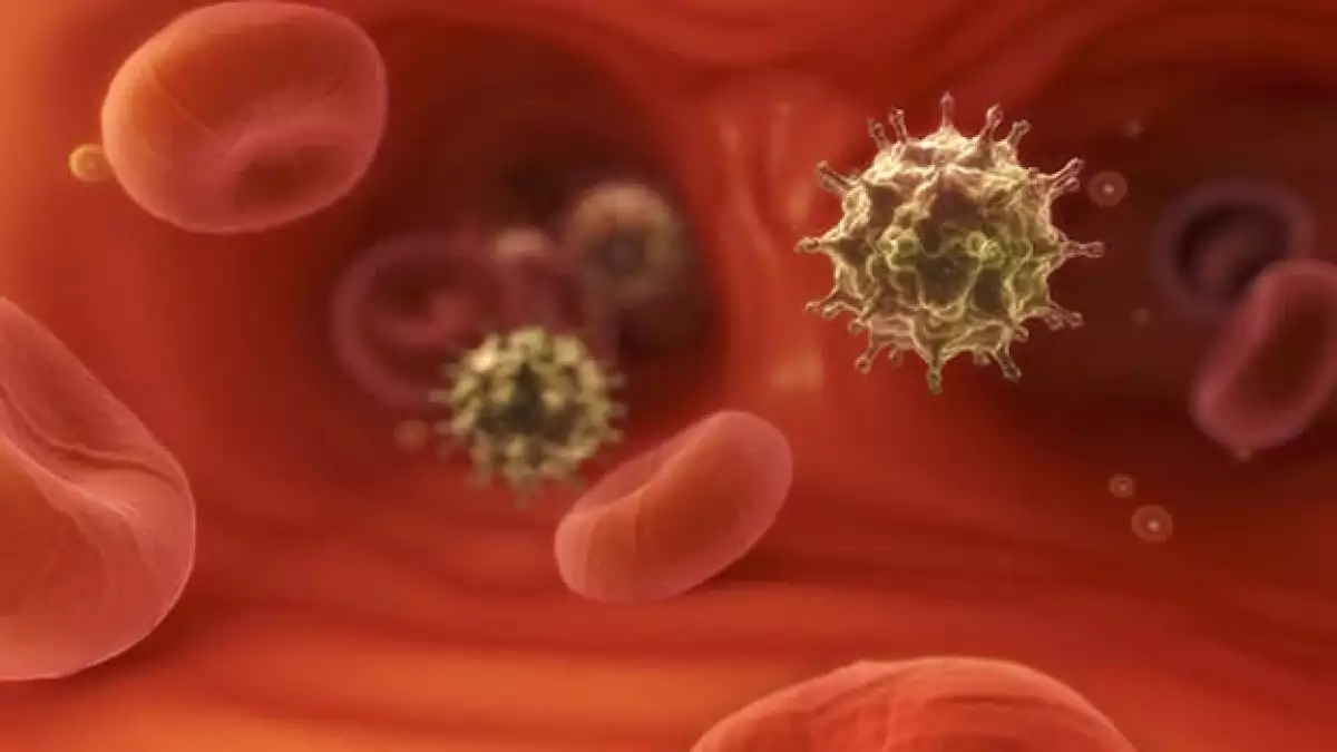 virus sida vih