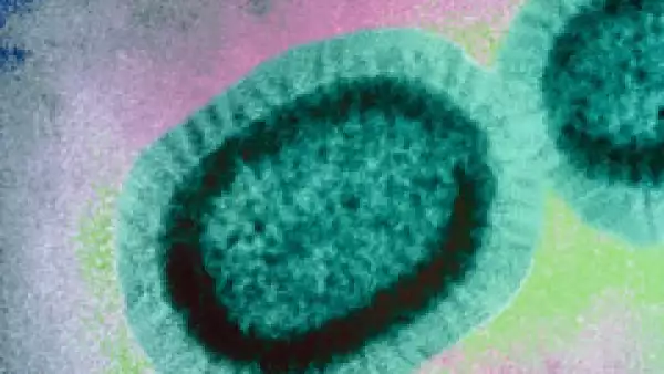 De acuerdo al estudio de Ernst & Young la influenza porcina puede llegar a ser una pandemia. (Foto: Cortesía Laboratorio Sanofi-Aventis y Sanofi-Pasteur)