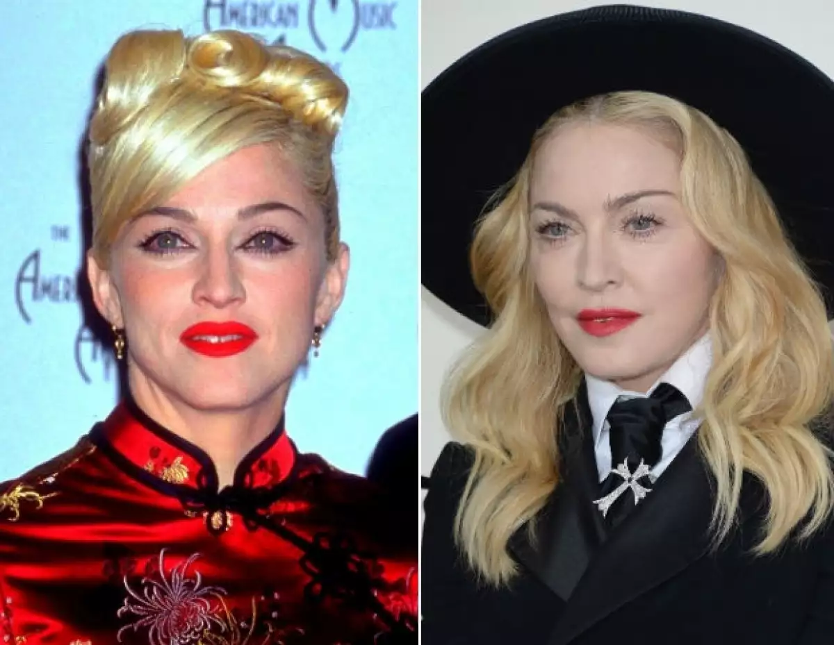 Madonna en 1999 y, a la derecha, a principios de año. Su rostro luce notablemente hinchado.