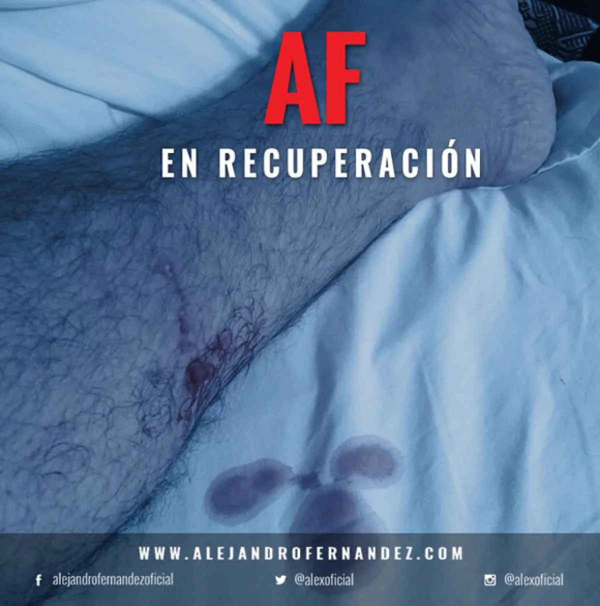Con esta imagen, Alejandro informó a sus fans que a pesar del accidente se encontraba bien.