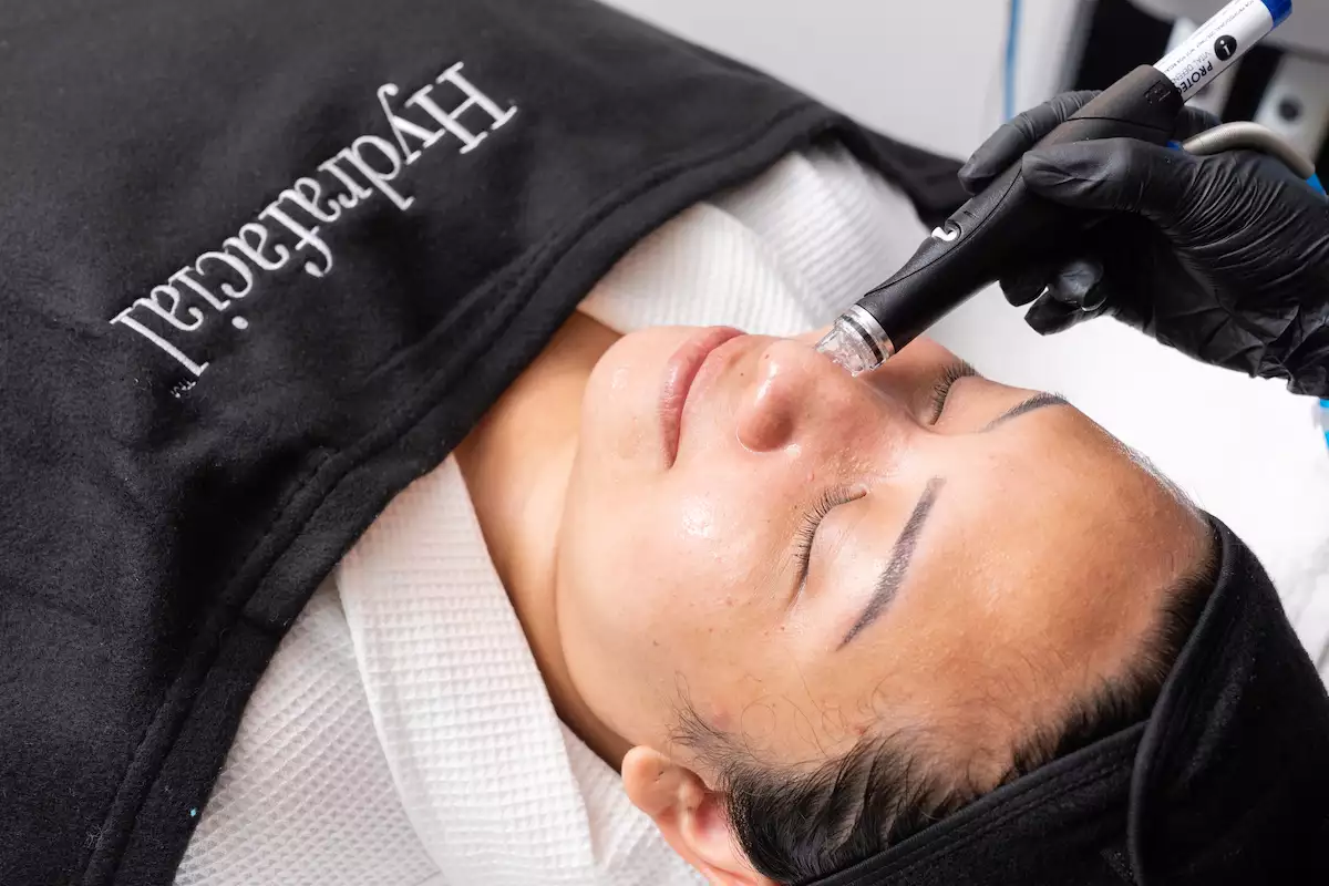 Hydrafacial