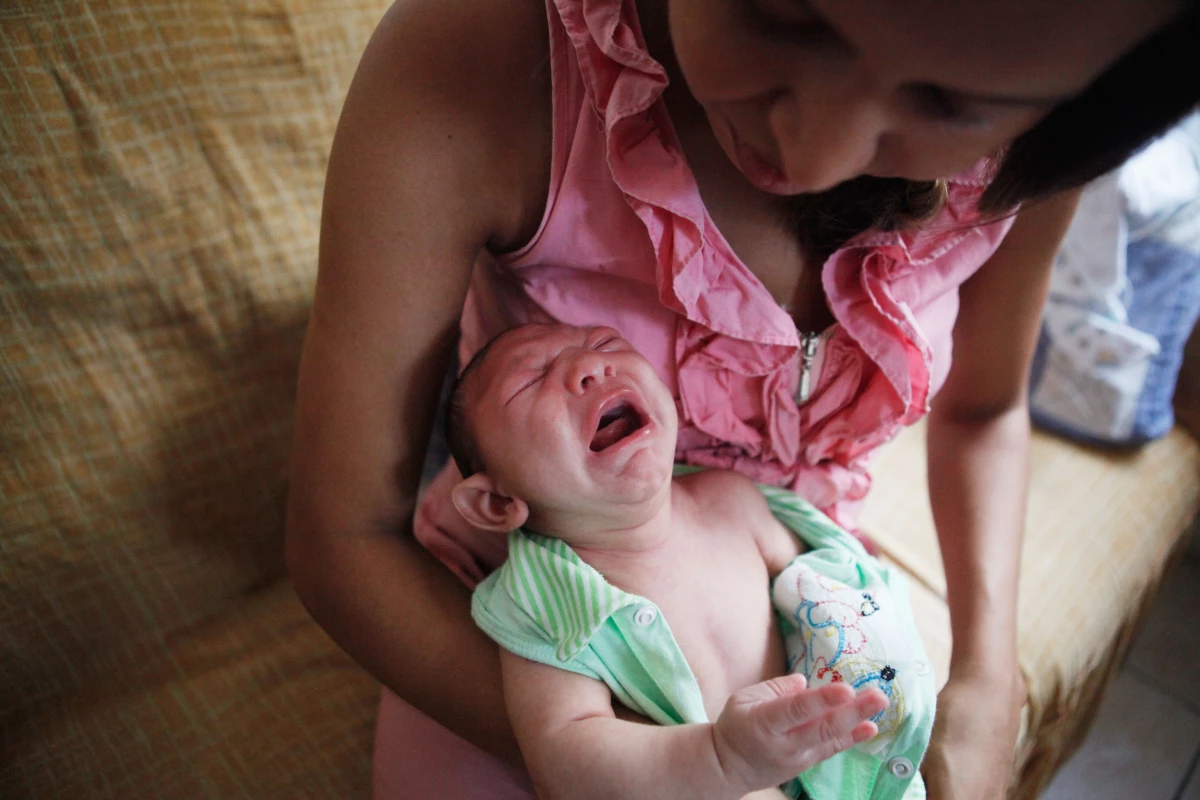 El virus del Zika también ha sido asociado a enfermedades motrices, como el síndrome de Guillain-Barré, además de microcefalia.