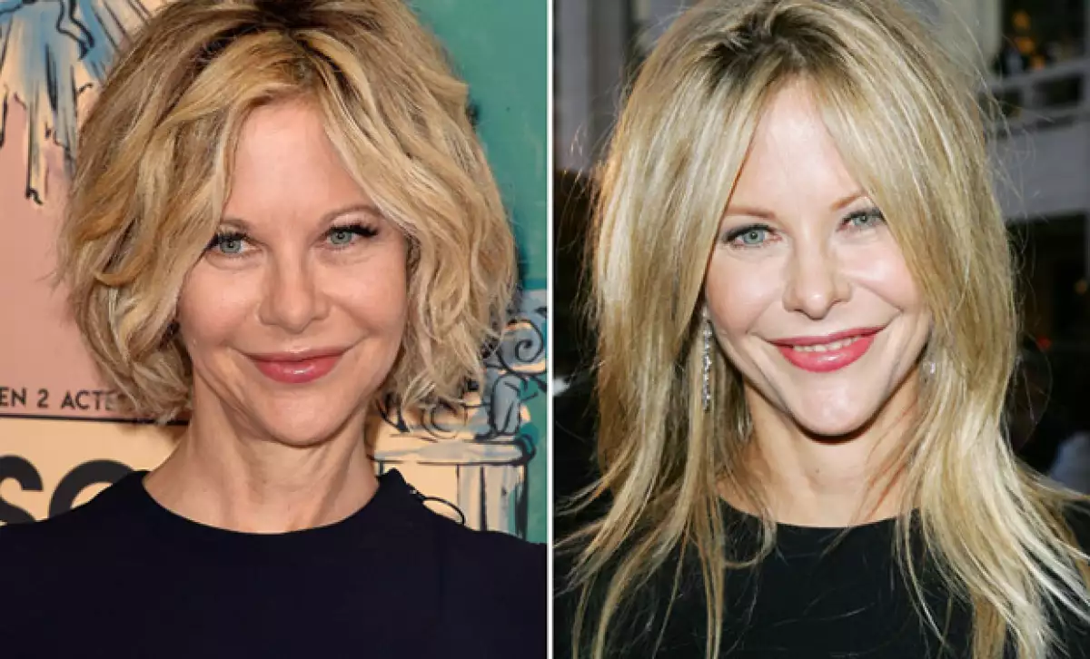 Aunque su increíble transformación se puede deber a sus expresiones o maquillaje, la intervención del bisturí en la cara de Meg es inminente.