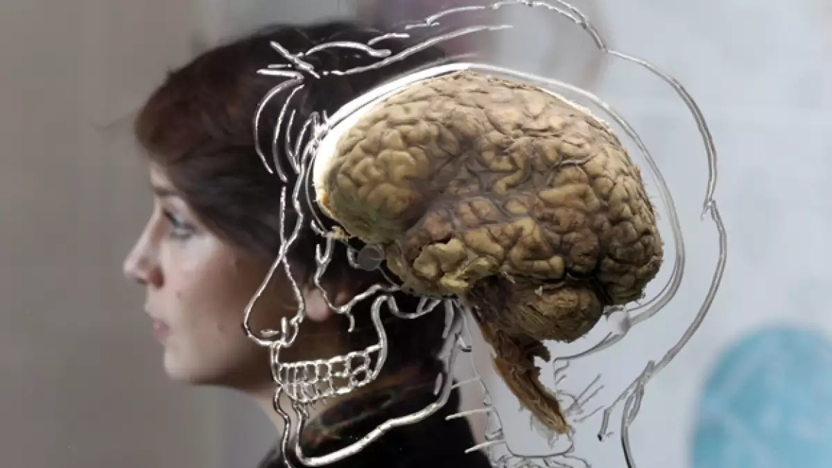 Cerebro