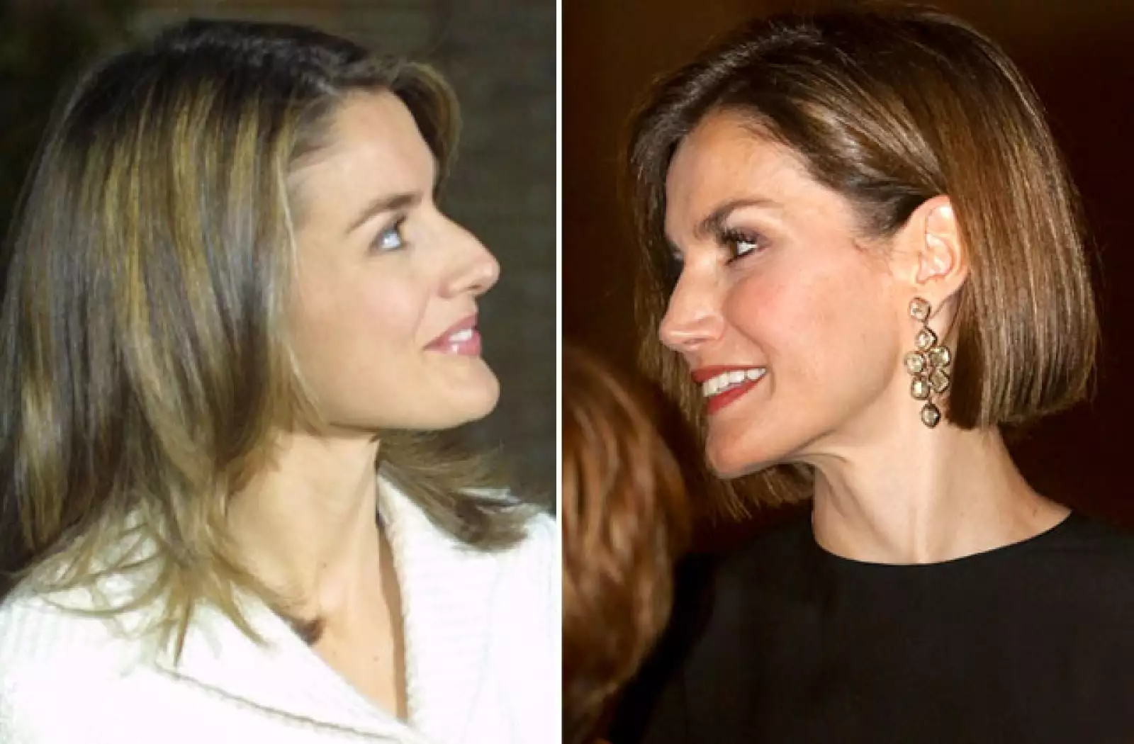 Con el paso de los años la reina Letizia ha ido estilizando su rostro, uno de sus cambios más notorios es su nariz. Se dice que se hizo una septorrinoplastia para corregir las irregularidades del tabique nasal.