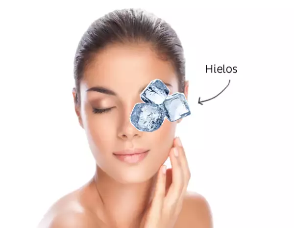 Aplica hielo en un trapo sobre los ojos para deshincharlos.