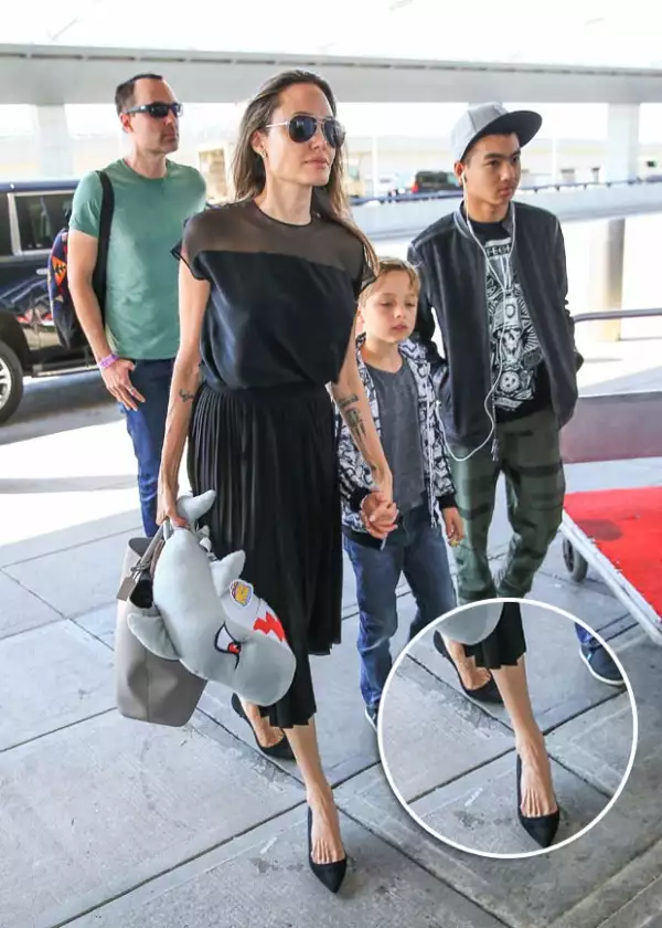 La parte que más impactó fue el empeine del pie.