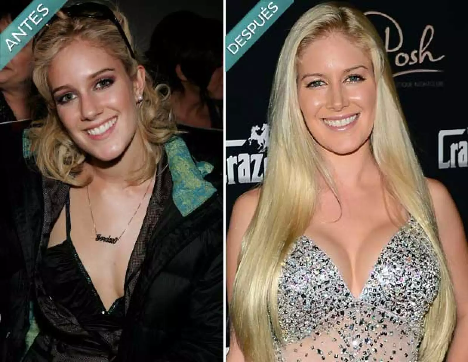 Heidi Montag es sin duda una de las famosas que más se ha empeñado en cambiar. Se arrepintió de las 10 cirugías y culpó a su médico por convencerla de realizárselas.
