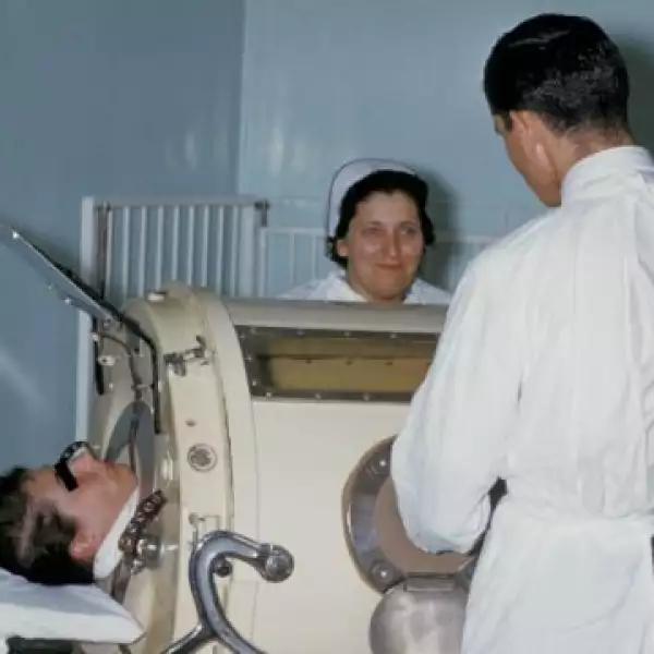 polio iron tratamiento 