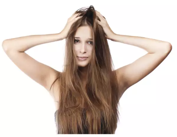 La caspa puede ser causada por estrés y fatiga.