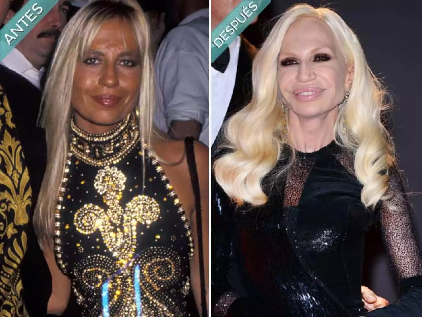 Donatella Versace se ha transformado drásticamente, en la lista de cirugías esta: implante de labios, liposucción y rinoplastia. El botox ha sido su mejor amigo.