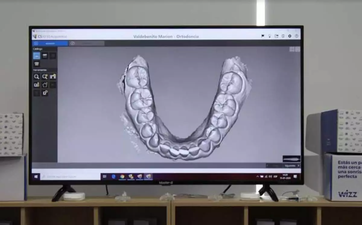 tecnología ortodoncia 