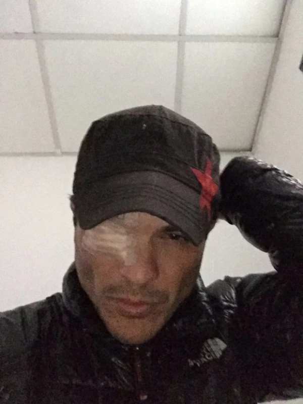 El actor espresó que el departamento de maquillaje de la producción no investigó que los químicos eran tóxicos.