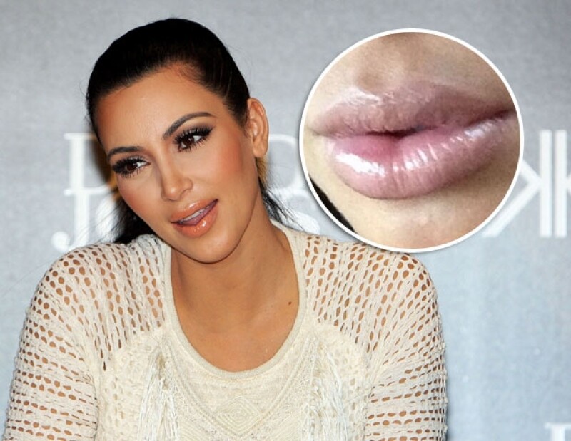 kim aseguró que el aumento en el volumen de sus labios se debe a su embarazo.