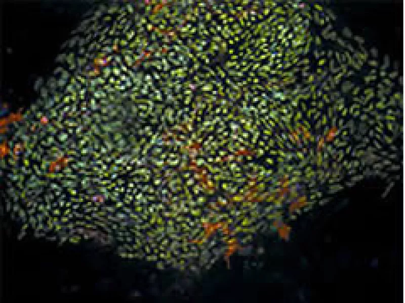 Las farmacéuticas están comenzando a desarrollar medicamentos con células madre adultas. (Foto: CNNMoney)