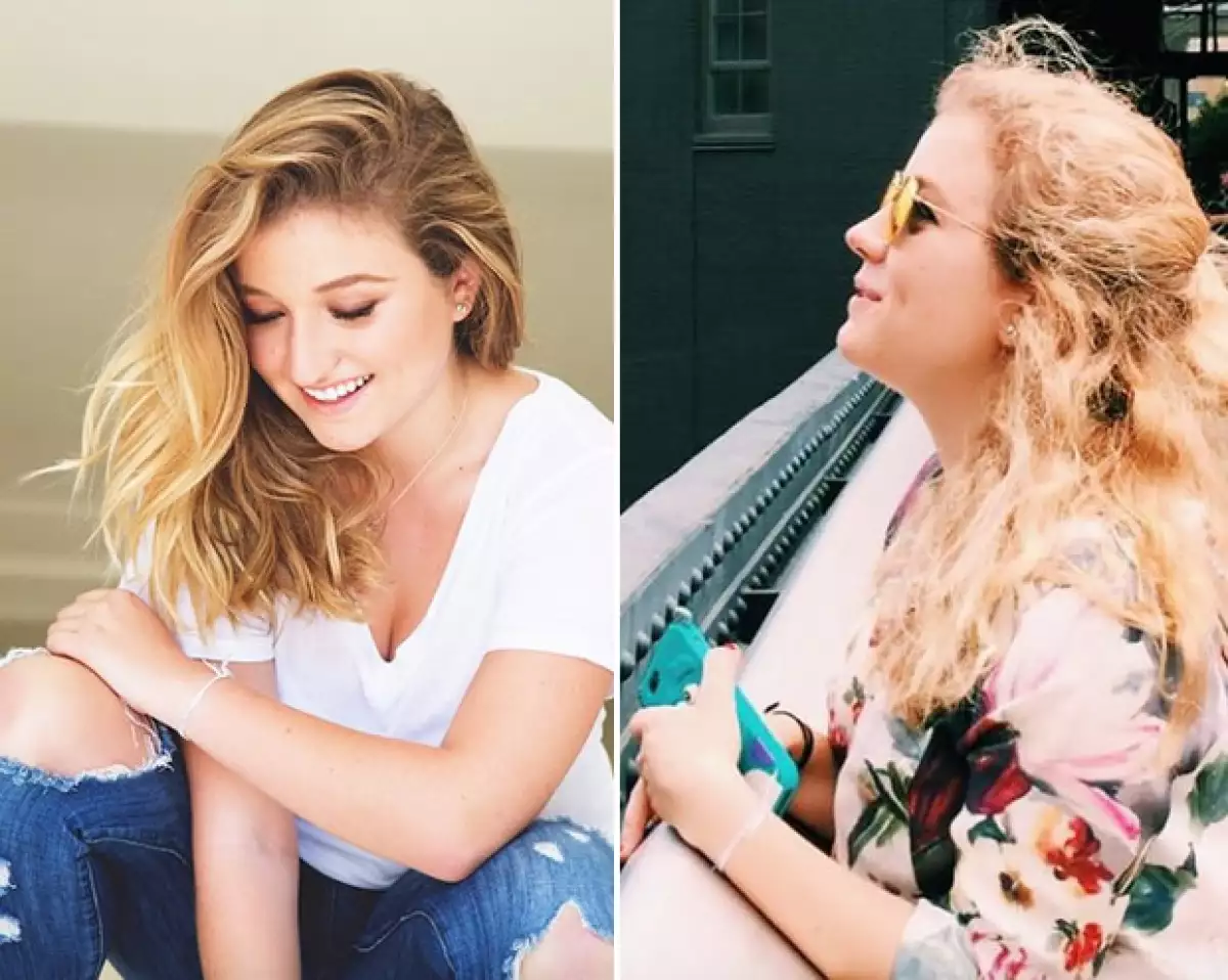 El perfil de Fernanda cambió completamente después de su cirugía.