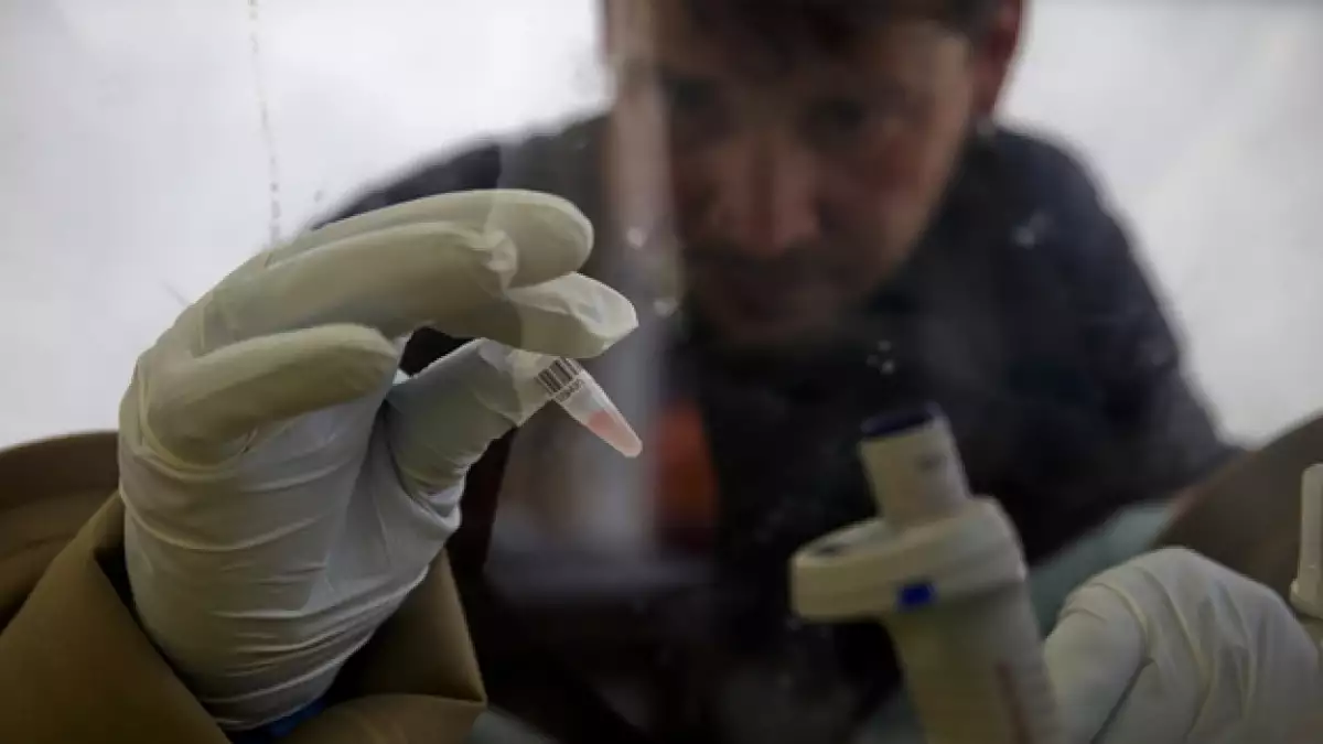 ebola virus