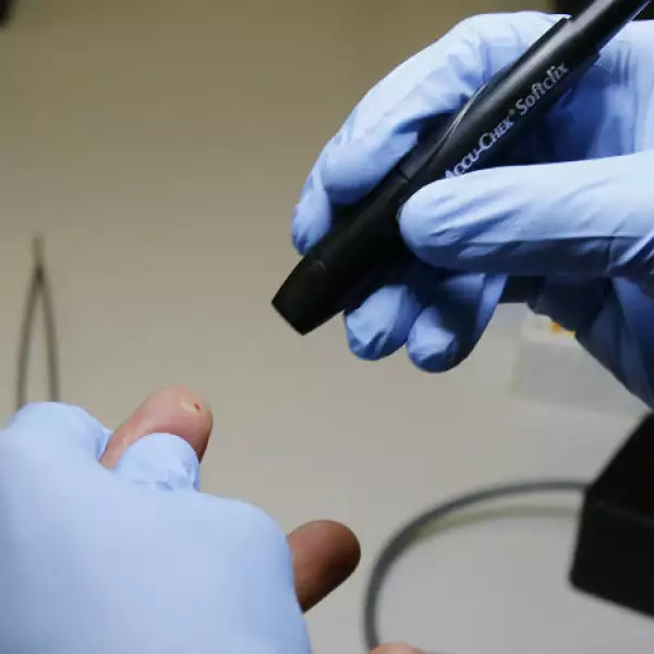 dispositivo Apolo del IPN 2