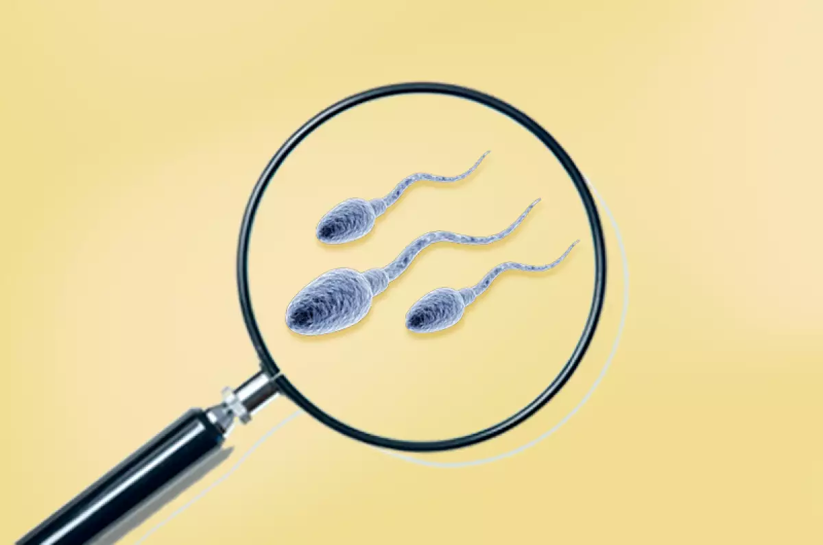 Vasectomia