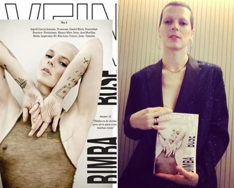 A principio de año Bimba Bosé tuvo que someterse a una cirugía para que le extirparan el seno izquierdo a causa del cáncer de mama. Y sin prejuicios posó para la revista "Vein" de España.
