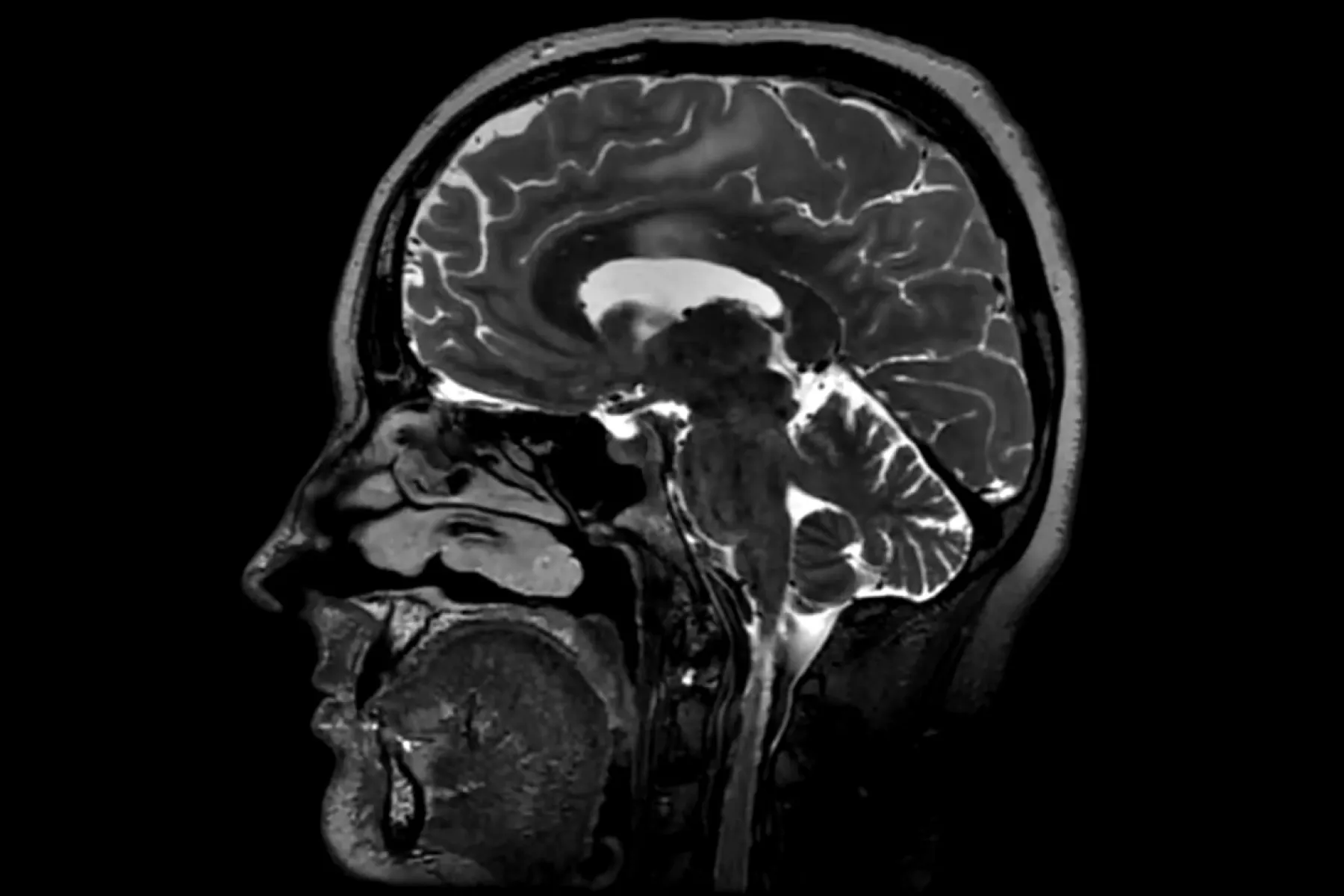 Los adolescentes de 30 años son una realidad, la Universidad de Cambridge revela las edades del cerebro