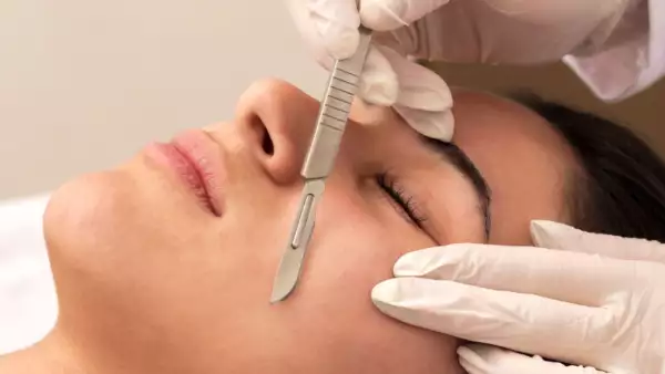 dermaplaning