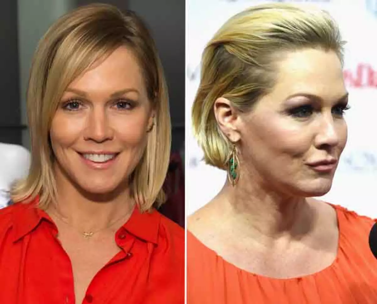 La actriz, conocida por la serie Beverly Hills 90210, desató rumores de haberse practicado botox o, incluso, de haberse realizado una cirugía estética para restirarsela.