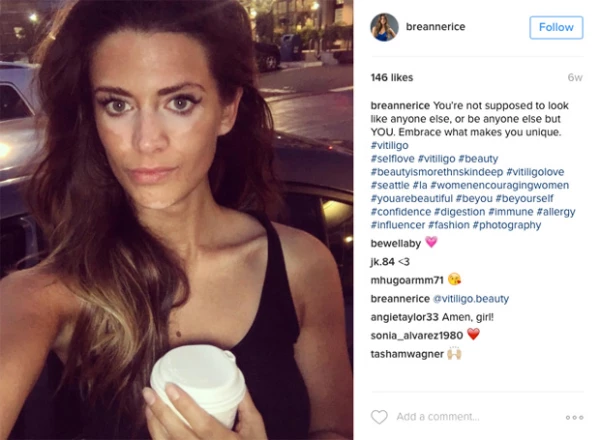 Breanne Rice se mostró al natural desde marzo de 2016.