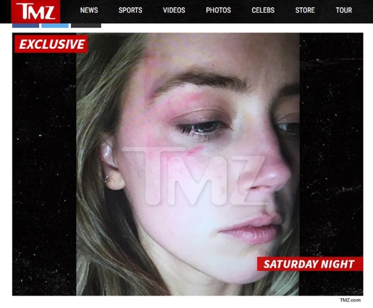 Según informa TMZ, la actriz mostró una imagen en la corte en la que aparece con la cara golpeada, alegando que el actor había sido el responsable de ello.