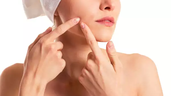 Tocarte la cara puede estar haciendo que te salgan granitos.